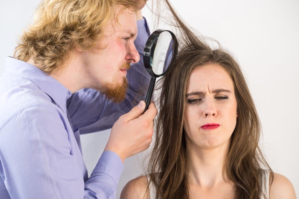 How can I Remove Dandruff? – Symptoms, Causes and Treatment