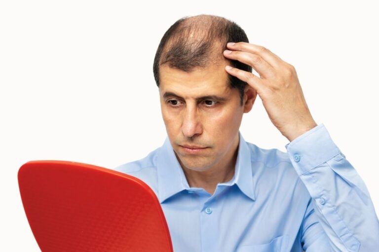 A Guide for the Bald and Balding