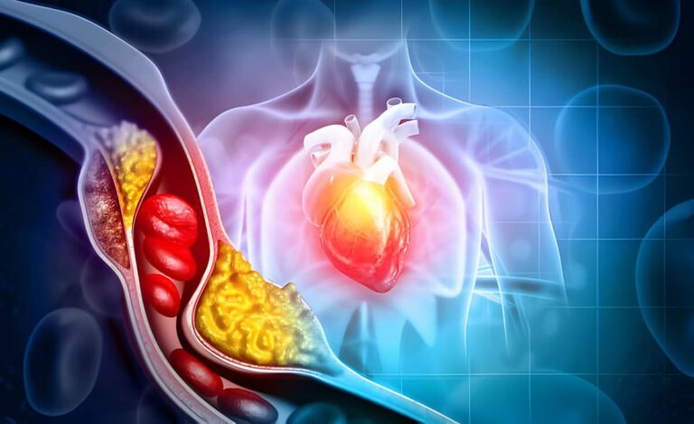 How to get rid of Blood Clots?