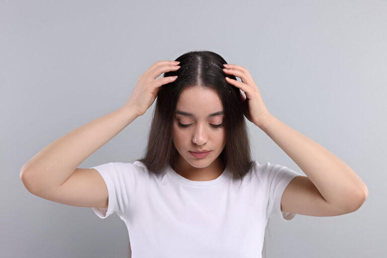 Top 4 Proven Dandruff Treatments