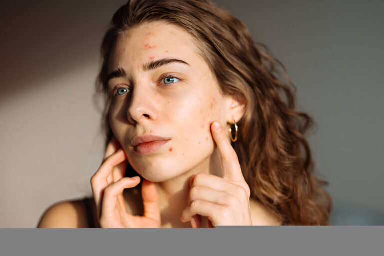 Sunscreen Also Fading Dark Spots